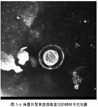 ZY016_11_5.gif